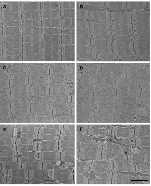Figure 4. Ultrastructural changes in muscle fibers after 8 or 9 hours of ischemia. Fibers from control muscle displayed normal morphology both in mitochondria-poor (A) and mitochondria-rich muscle fibers (the latter were assumed to be red fibers) (B)