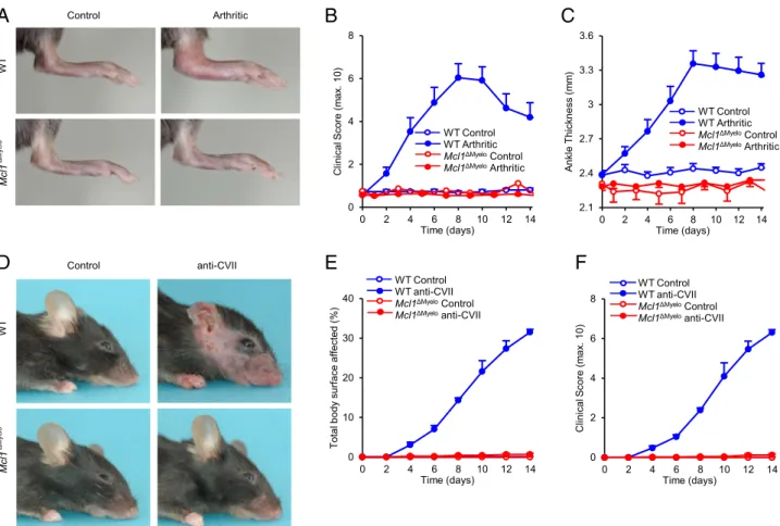 FIGURE 4. Autoantibody-induced arthritis and skin-blistering disease in Mcl1 DMyelo mice