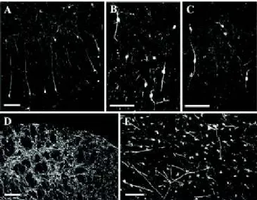 Fig. 4. Characterization of patterns B and C neurons. Cortical bi- and multipolar interneurons are seen in (A) the hippocampus and (B) parietal cortex after incubation with group B serum, and (C) in the parietal cortex after incubation with group B CSF