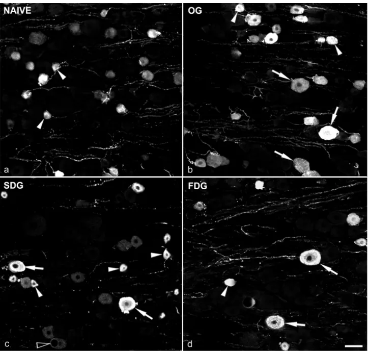 Fig. 3. Confocal images showing SP immunoreactivity in S1 dorsal root ganglia. DRGs were obtained from a) naïve, b) osteotomized  (OG), c) slow (SDG), and d) fast (FDG) distraction groups