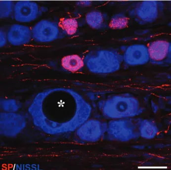 Fig.  6.  Double labelled confocal image of a S1 ganglion taken  from an animal in the slow distraction group