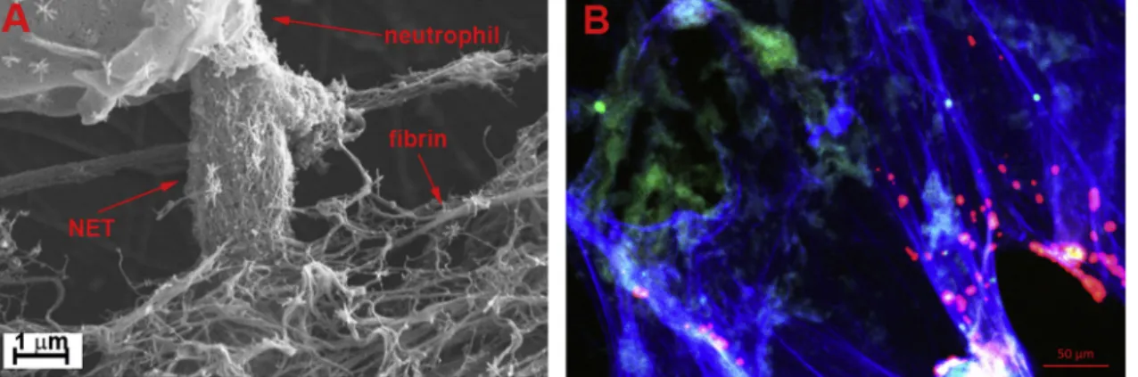 Fig. 1. Intertwined ﬁ brin and NET sca ﬀ olds of thrombi. A: Scanning electron micrograph of NETs released by phorbol myristate acetate-activated isolated neu- neu-trophils in a ﬁbrin clot