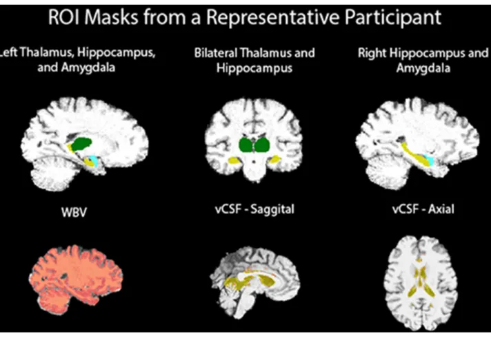 Fig 1 illustrates brain regions investigated in our study mapped onto a participant’s brain.