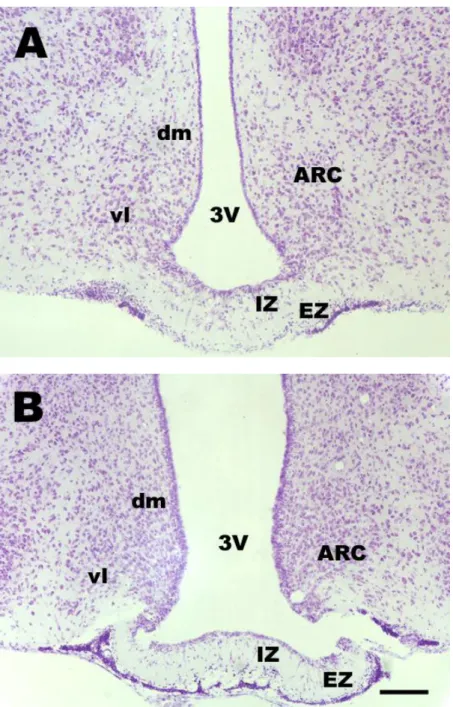 Fig. 8. Microphotographs demonstrating ARC in the frontal sections of a midlactating rat hypothalamus at  two  rostrocaudal  levels