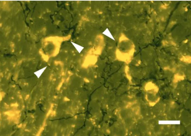 Fig. 14. Microphotograph shows DYN immunoreactive cell bodies (orange colour) and BDA fibers (black  colour)