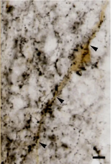 Fig. 15. Microphotograph shows a TIDA neuron (brown colour) which is heavely innervated by DYN fibers  (black  colour)