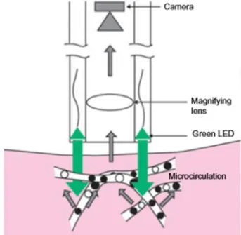 Figure 8: The SDF technique: the light source consists of diodes emitting light, placed  concentrically around the optics