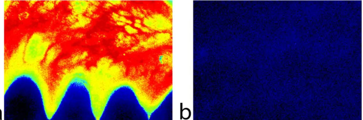 Figure 10: Color-coded LSCI images of healthy untreated gums (a) and forearm skin  (b) with the same setup parameters