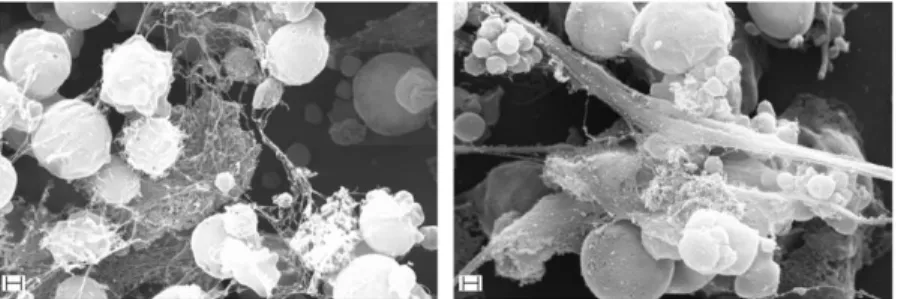 2. ábra. SEM (pásztázó elektronmikroszkópos) felvételek  aktivált  neutrofil  granulocitákból  származó  neutrofil  extracelluláris csapdákról