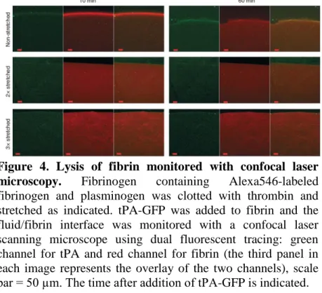 Figure  4.  Lysis  of  fibrin  monitored  with  confocal  laser  microscopy.  Fibrinogen  containing  Alexa546-labeled  fibrinogen  and  plasminogen  was  clotted  with  thrombin  and  stretched  as  indicated