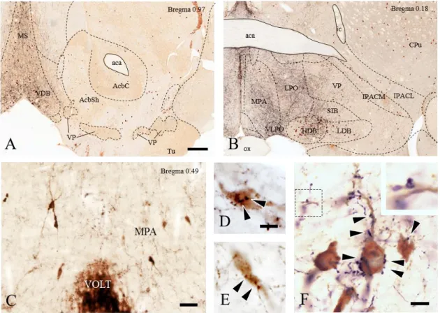 Fig. 6. Dual immunohistochemical labeling to identify the relationship between GLYT2- GLYT2-IR  fibers  and  GnRH-  or  ChAT-GLYT2-IR  neurons  in  the  basal  forebrain