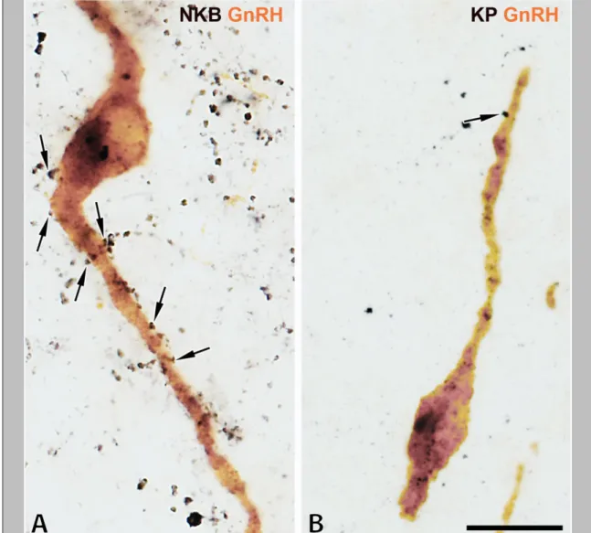 Figure 9. NKB-IR axons (black color in A) show a much higher abundance in the Inf  and establish considerably more axo-somatic and axo-dendritic juxtapositions (arrows)  onto  GnRH-IR  neurons  (brown  color)  than  do  KP-IR  axons  (black  color  in  B)