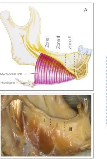 Figure  15.  Drawing  (A)  and specimen photography  (B)  illustrating  the  anatomy  of  the  typical  insertion  of  the  mylohyoid  muscle  on  the  internal  aspect  of  the  mandibular  body  and  the  location  of  Zones I, II and III