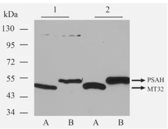 Figure 8: Verifying the specificity of aptamers by Western-blot analysis. 20-20 µg/lane MT32 (A) and PSA- PSA-H (B) coat protein overexpressing total E