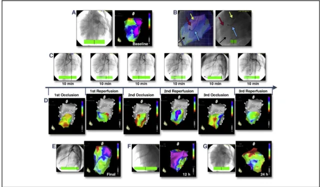 FIGURE 1 Real-Time In Vivo Visualization of Ischemic Burden During Myocardial I/R and at 12-h and 24-h Follow-Up