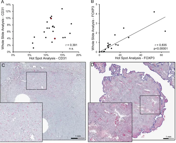 Figure 4. Correlation of hot spot analysis and whole slide analysis of immunovascular markers in osteosarcoma