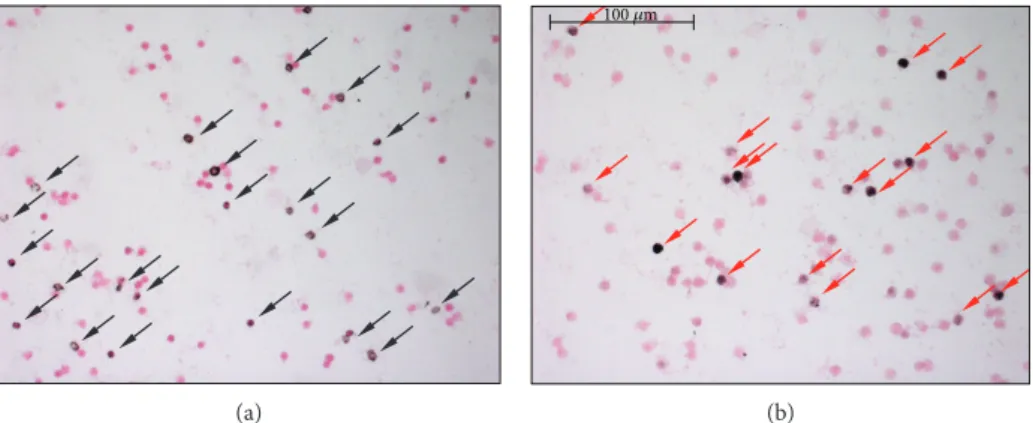 Figure 1: Immunostaining of leukocyte smears. (a) Representative microscopic image of leukocyte smears stained against nitrotyrosine.