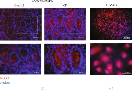 Figure 1: The presence of PARK7 in duodenal epithelial cells. Localization of PARK (red) was investigated by immuno ﬂ uorescence staining in duodenal mucosa of children with celiac disease (CD) and controls (a) and in FHs74Int cells (b)
