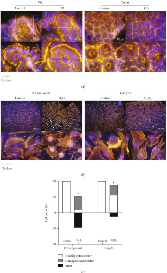 Figure 4: Cytoskeletal disruption of intestinal mucosa in celiac disease (CD) and of duodenal epithelial cells