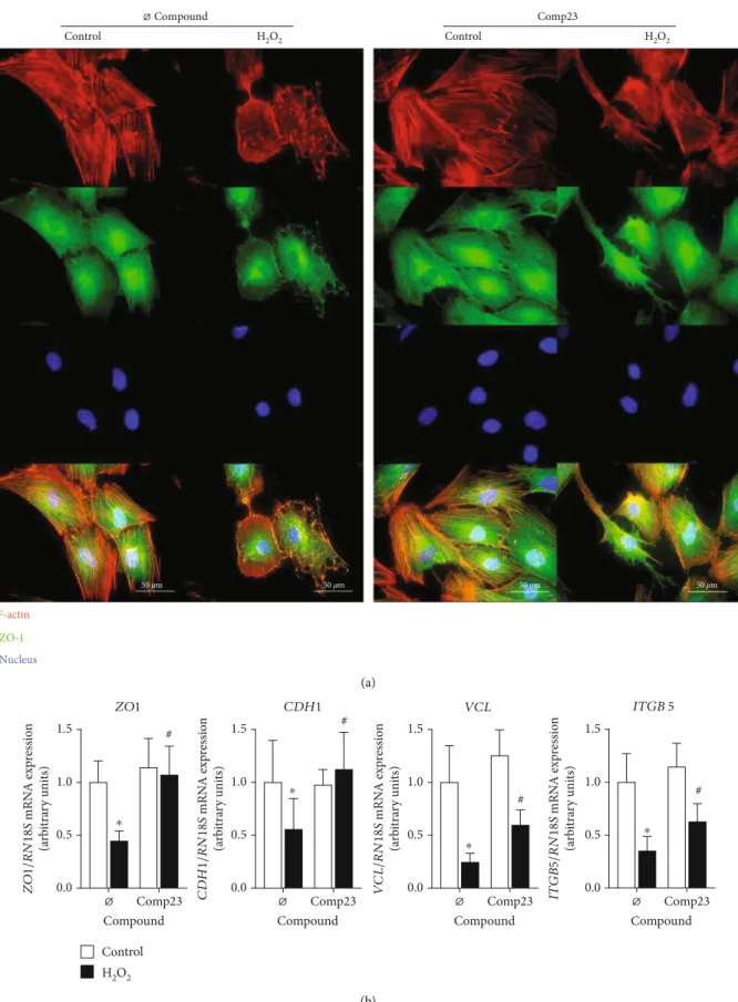 Figure 5: Damage of cell adhesion in epithelial cells induced by oxidative stress. Colocalization of actin (red) and zonula occludens 1 (ZO-1, green) was investigated by immuno ﬂ uorescence staining (a) in FHs74Int duodenal epithelial cells after treatment