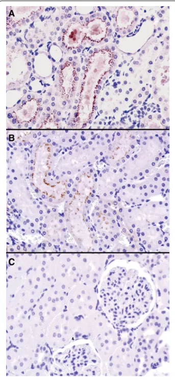 Figure 2 Anti-myoglobin immunohistochemistry (Gill ’ s hematoxylin as background staining, 200x and 600x magnification)