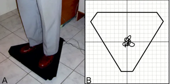 2. ábra A poszturográfiás platform (A) és sematikus rajza (B). A vékony fekete vonal a beteg súlypontjának elmozdulását jelöli a vizsgálat 20 másodperce alatt