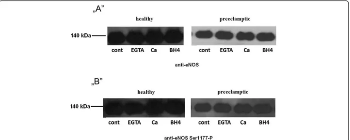 Fig. 3 Effect of pravastatin on eNOS Ser1177. „ A ” is a typical result of western blot with anti eNOS antibody „ B ” is a typical result of western blot with anti eNOS phosphorylated on Ser1177 cont t= 0 min incubation, EGTA= 1 mM EGTA, 10 min incubation;