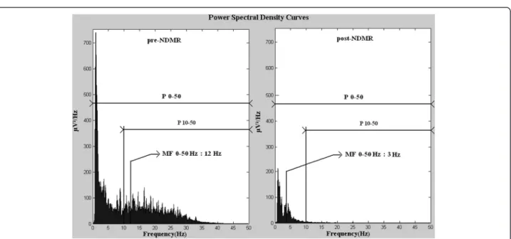 Figure 4 Average PSD curves pre- and post-NDMR administration (n=7). Power and median frequency decreased due to the medication.