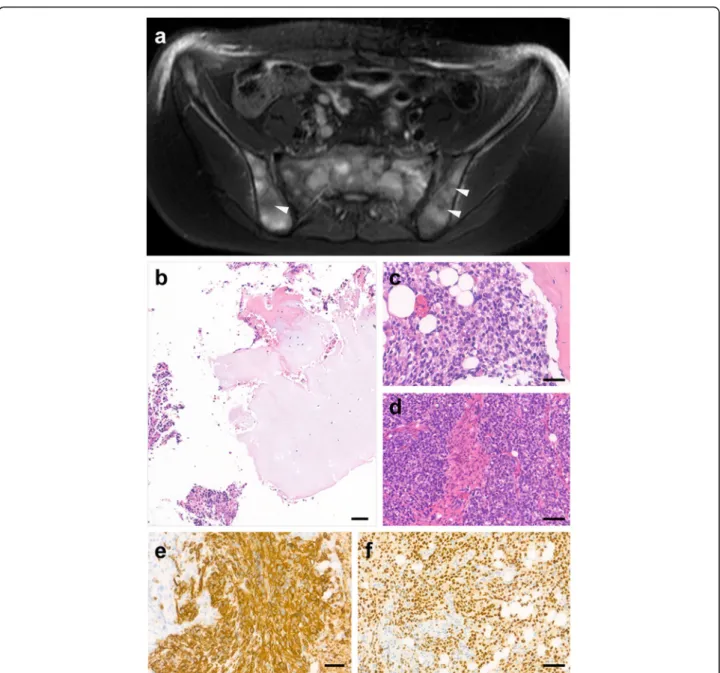Fig. 3 Radiological image and histopathology of Case 2. a On the axial T2 SPAIR image of the pelvic bone multiple, partially coalesced tumor nodules are visible in the bone marrow