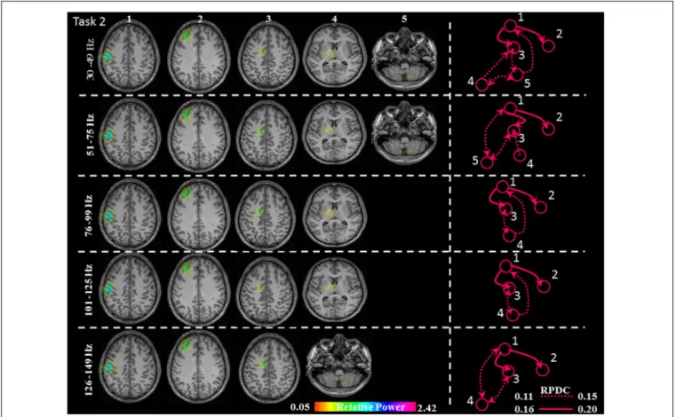 FIGURE 5 | Relative gamma synchronization at the onset of the brisk pressing, Task 2. Results of the source and directionality analysis in the five frequency bands.