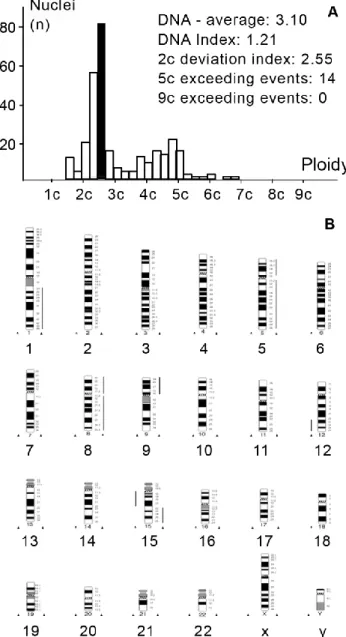 Figure  10.  Representative  DNA  histogram  (A)  and  HR-CGH  ideogram  (B)  of  aneuploid  synovial  sarcoma (case 2)