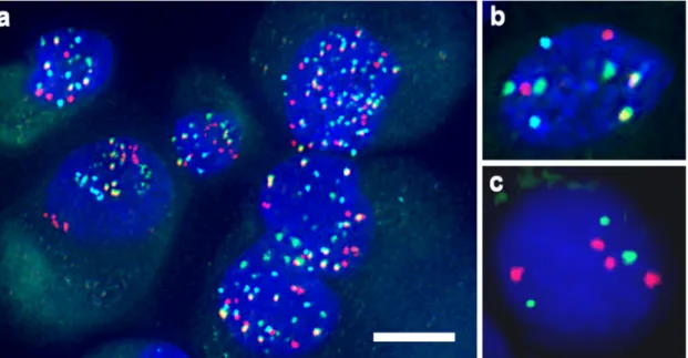 Fig 4. Examples of numerical chromosomal and telomeric alterations in GCTB stromal cells of male patients