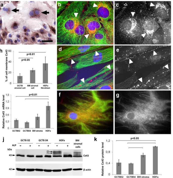 Fig 5. Detection of Cx43 levels and the subcellular distribution of Cx43 protein in primary GCTB stromal cell, bone marrow stromal (BM) cell and HDFa fibroblast cultures