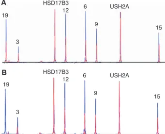 Figure 5: Haplotype analysis of the family F84 with a de novo   deletion.