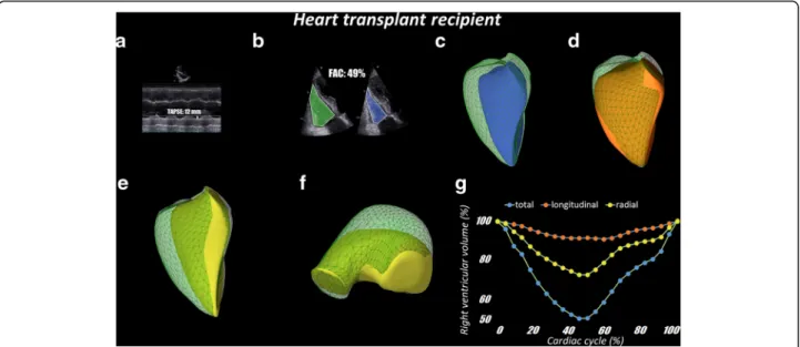 Fig. 8 Representative pulmonary hypertension patient. Panel a: TAPSE (23 mm) was normal