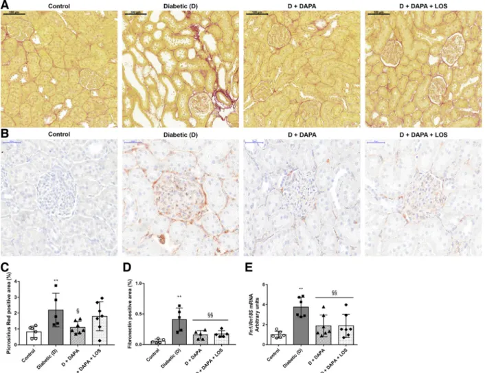 Fig. 3. Diabetes-induced collagen and fibronectin deposition is ameliorated by dapagliflozin (DAPA)