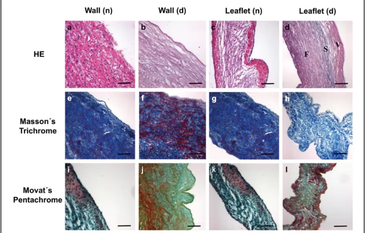 Figure 4.    Heart valve tissue structure after decellularization. Hematoxylin-eosin (HE) staining of (a) native heart valve wall and (b)  after decellularization, and native leaflet before (c) and after decellularization treatment (d;  [F, fibrosa section
