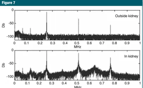 Figure 7: Measurement of acoustic emission during sonication. Spectra were acquired during pulses delivered at two locations: one site without evident bubble activity (in water) and one with wideband emission.