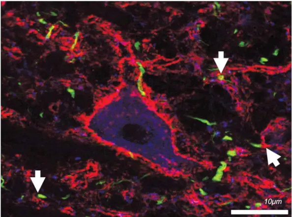 2. ábra Hármas immunﬂ uoreszcens jelölés egy aggrekántartalmú (piros) perineuronalis hálóval rendelkező gátló (GAD-immunoreaktív, kék) interneuron- interneuron-ról a patkánynucleus ruberében