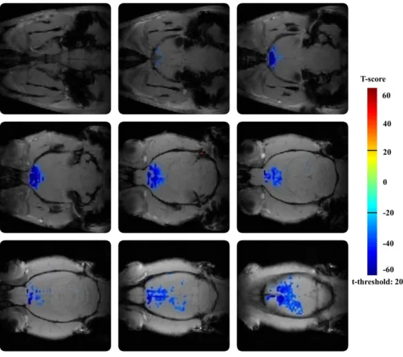 Figure 11  Effect  of  buscopan  on  BOLD  response  in  the  rat  brain  after  vehiculum pretreatment