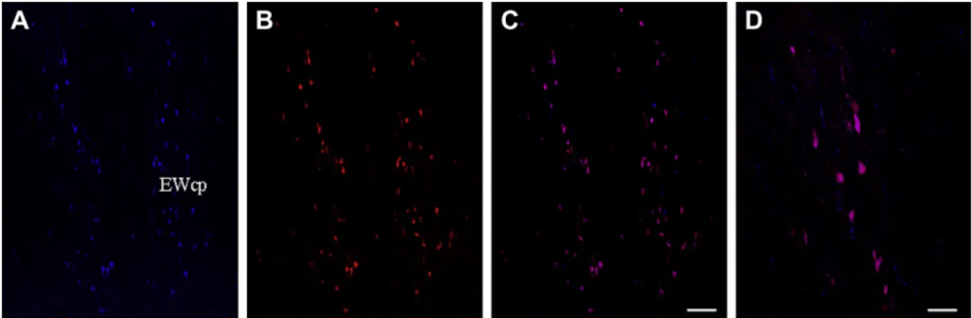 Fig. 1. Representative photomicrographs depicting the distribution and colocalization of CART-ir and nesfatin-1-ir in the human (AeD) Edinger-Westphal nucleus