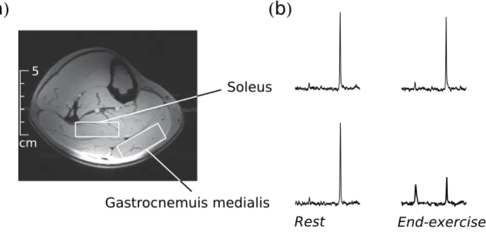 Figure 9.  Typical position of the voxels in soleus and gastrocnemius medialis muscle, respectively, for localized 