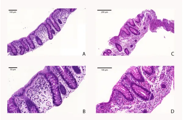 Figure 5. Reference of the histologic assessment. Detection of eosinophil cells with Hematoxylin and  Eosin (H&amp;E) staining: 3–4/HPF eosinophil cells were detectable in normal biopsy (A, B)