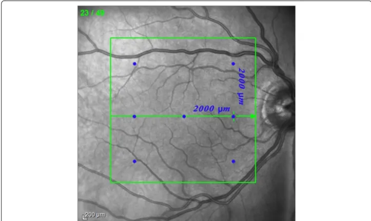Figure 1 The blue dots on the infrared fundus image denote the measurement points used in the study