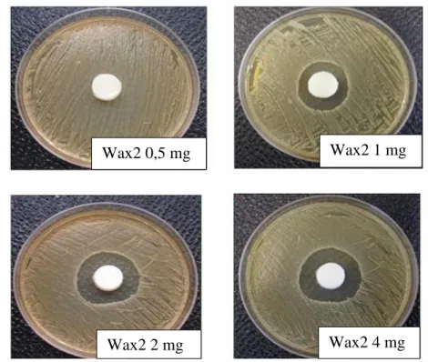 3. ábra: Gátlási zónák mérete 0,5, 1, 2, és 4 mg vancomycint tartalmazó Wax2 viaszkorong  esetében egy éjszakán történt inkubálást követően (saját felvétel)