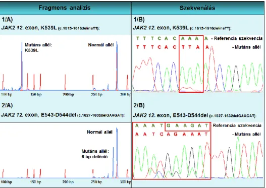 8. ábra A JAK2 gén 12. exonjában található mutációk kimutatása fragmens analízissel  („A”  panelek)  és  szekvenálással  („B”  panelek)