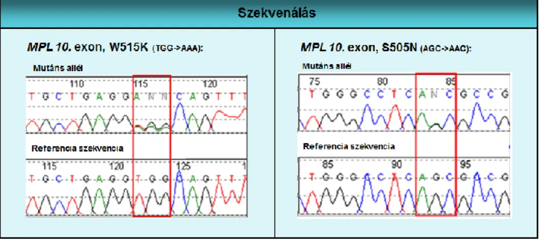 11. ábra Az MPL gén szekvenálása során kapott fluoreszcens regisztrátumok: a mutáns  allél a referencia szekvenciához viszonyítva