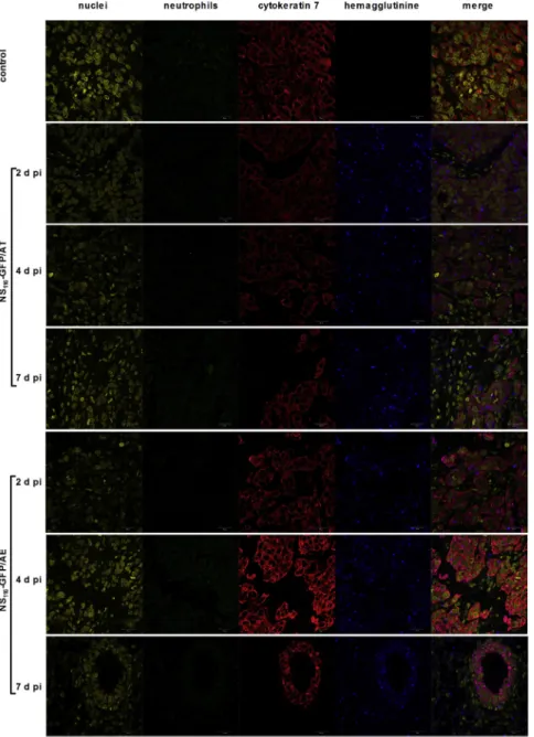 Figure 6. Detection of Viral Proteins and Neutrophil Infiltration in Tumor Tissue