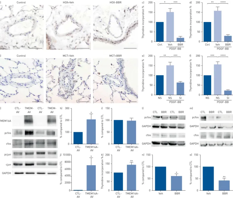 FIGURE 6 Role of TMEM16A in the proliferation of human pulmonary artery smooth muscle cells (PASMCs)