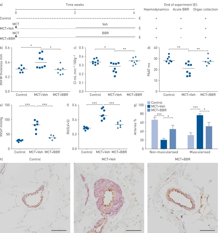 FIGURE 5 Chronic treatment with the TMEM16A inhibitor benzbromarone (BBR) reverses vasoconstrictive pulmonary artery remodelling in monocrotaline (MCT)-treated rats